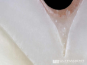 UltraSeal XT hydro sluit pits en fissuren volledig af zonder microlekkage.