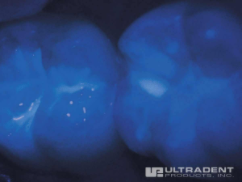 Dankzij zijn fluorescerende eigenschappen is UltraSeal XT hydro goed zichtbaar onder een blacklight.